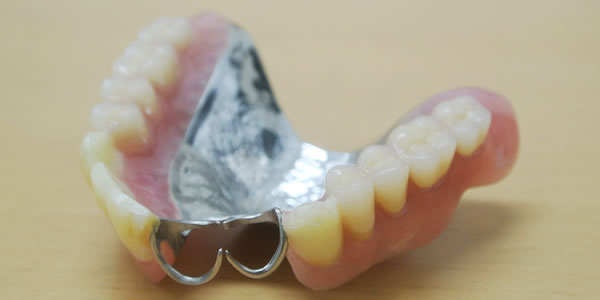 金属床の部分義歯